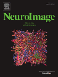 neuroimage